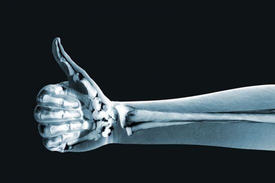 Radiografía utilizada para diagnosticar el dolor en las articulaciones de los dedos. 