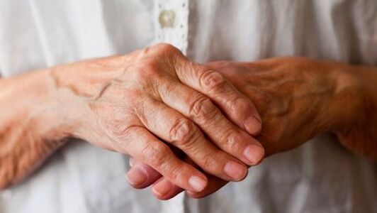artritis reumatoide como causa de dolor en las articulaciones de los dedos