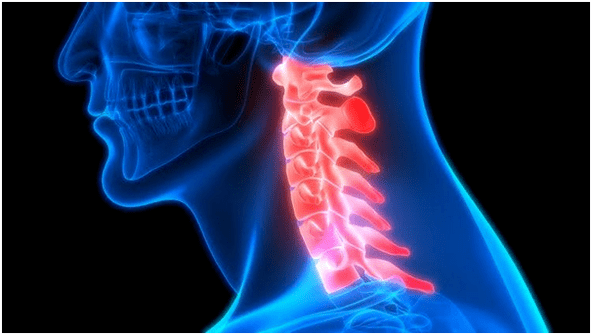 El dolor de cuello provoca dolor de espalda