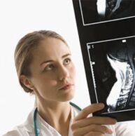El diagnóstico de osteocondrosis se especifica utilizando un examen de haz X