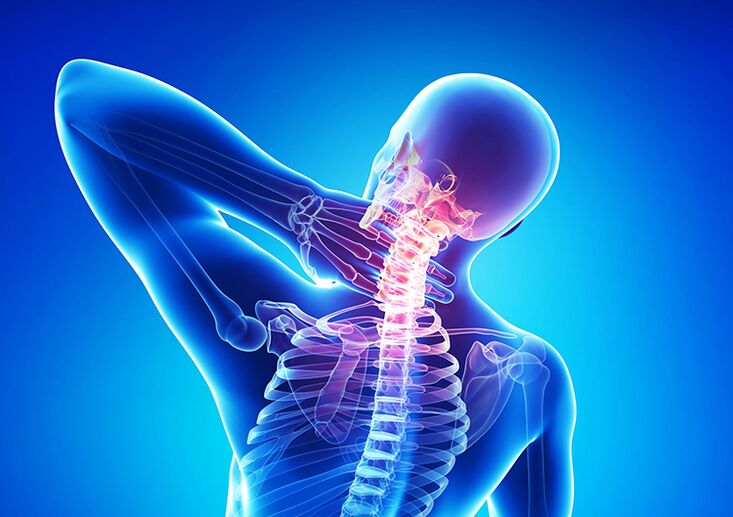 La osteocondrosis espinal es una enfermedad que afecta el cartílago articular y las vértebras.