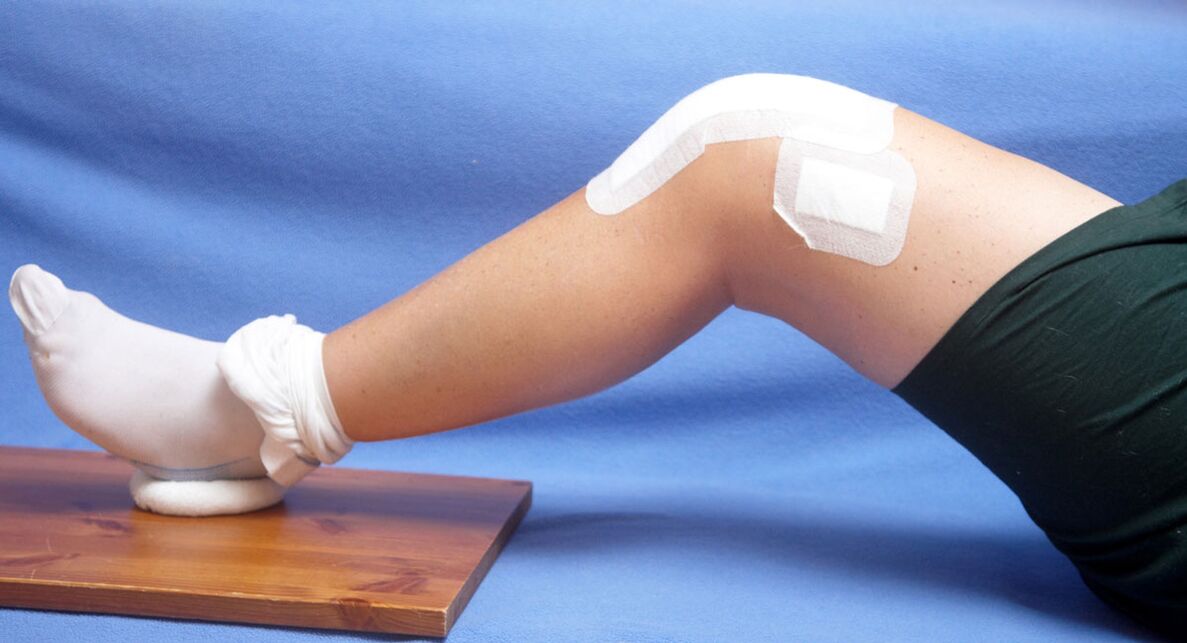 Tratamiento de la osteoartritis de la articulación de la rodilla.